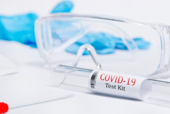 Test du Kit CAME FROG-AE Moteur enterré 230V pour les portails battants